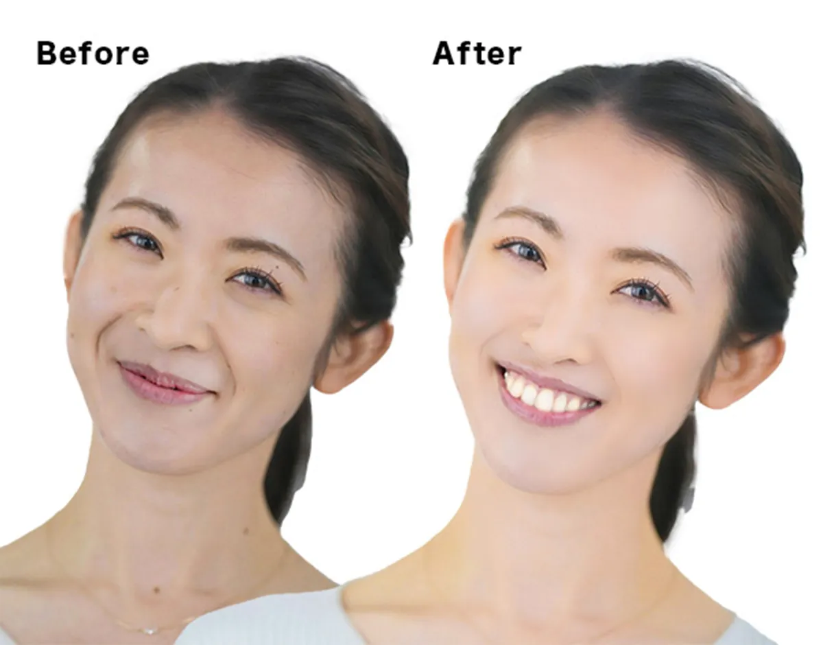 プロフィール写真の画像修正とレタッチ