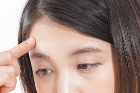 眉間のニキビを気にする女性　眉間のニキビの原因と特徴とケア方法