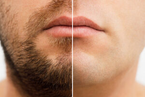 髭が有無の男性の顎